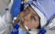 22岁美甲师手术成功却在复苏室脑死亡，家属称缺氧30分钟监护医生未察觉，医院回应