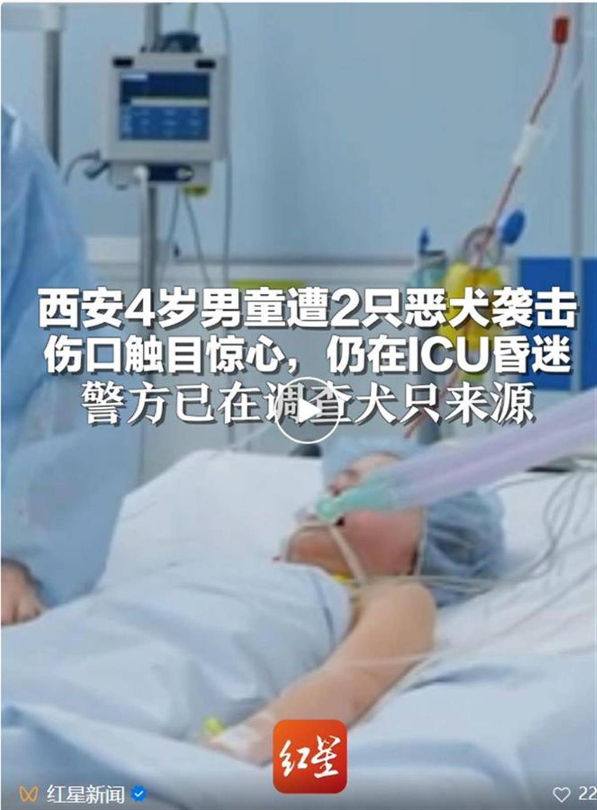 4岁男童遭恶犬袭击住进ICU，狗咬人为何就管不住？